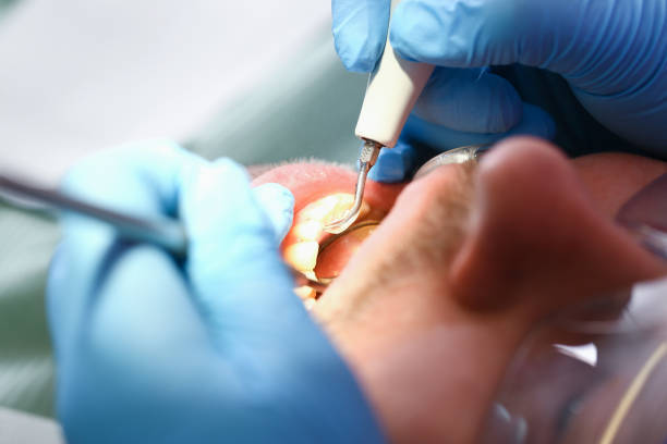 Best Urgent Dental Care for Toothache in Ada, OK
