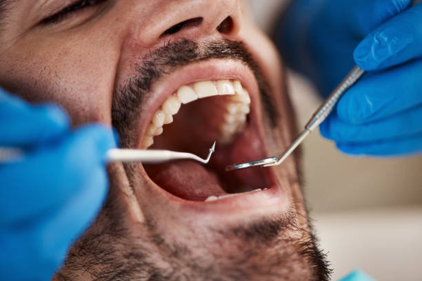 Best Emergency Dental Extractions in Ada, OK